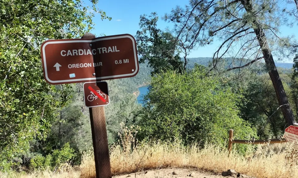 Cardiac Loop, United States